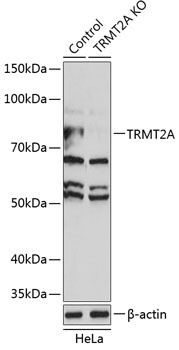 Anti-TRMT2A Antibody [KO Validated] (CAB19987)