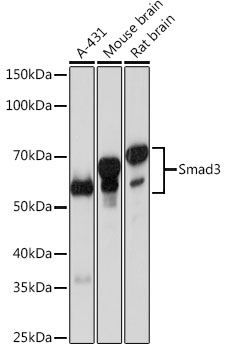 Anti-Smad3 Antibody [KO Validated] (CAB19115)