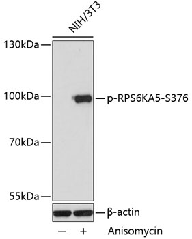 Anti-Phospho-RPS6KA5-S376 pAb (CABP0800)