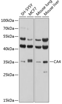 Anti-CA4 Antibody (CAB2677)