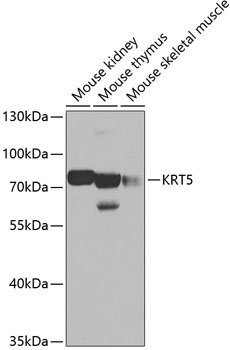 Anti-KRT5 Antibody (CAB2662)