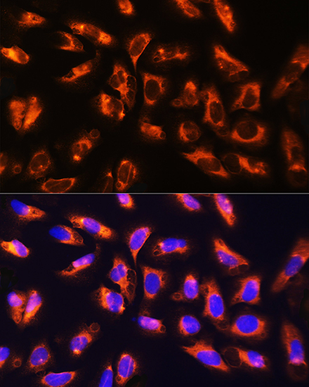 Anti-ADAM9 Antibody (CAB5388)