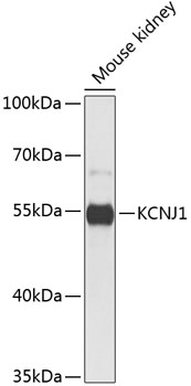 Anti-KCNJ1 Polyclonal Antibody (CAB8554)