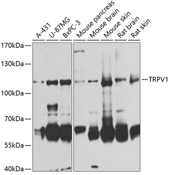 Anti-TRPV1 Polyclonal Antibody (CAB8564)