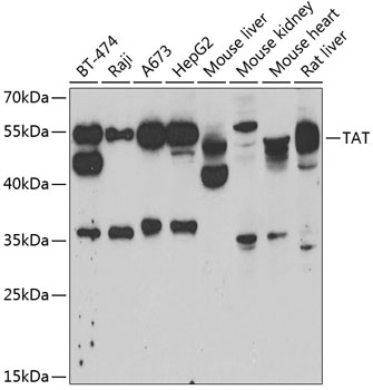 Anti-TAT Antibody (CAB6764)
