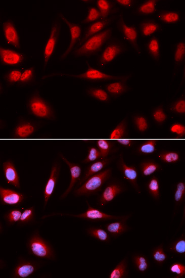 Anti-PDPK1 Antibody (CAB1665)