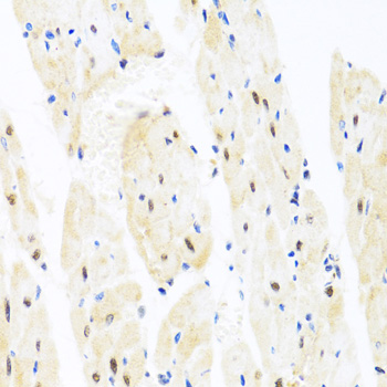 Anti-TAF9 Antibody (CAB2021)