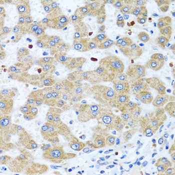 Anti-NMU Antibody (CAB7068)