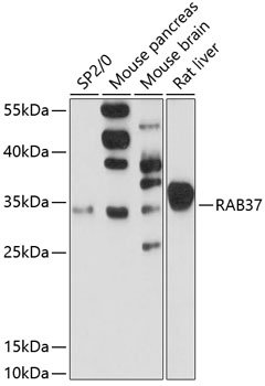Anti-RAB37 Antibody (CAB13704)