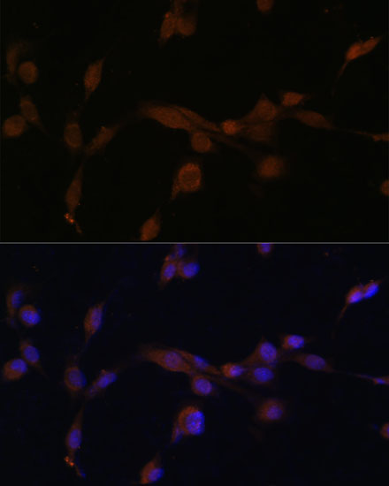 Anti-ATG7 Antibody (CAB0691)