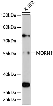 Anti-MORN1 Antibody (CAB13194)