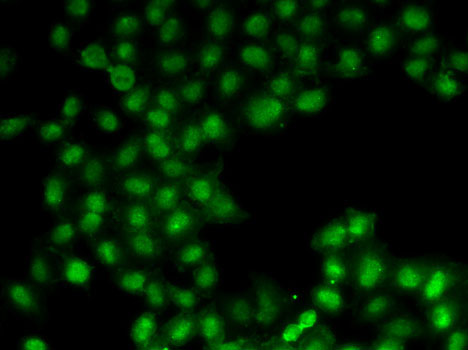 Anti-C11orf30 Antibody (CAB6138)