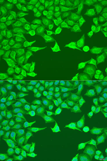 Anti-ATG9A Antibody (CAB5571)