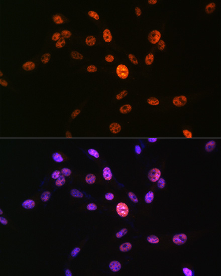 Anti-Phospho-Histone H3-S10 pAb (CABP0840)