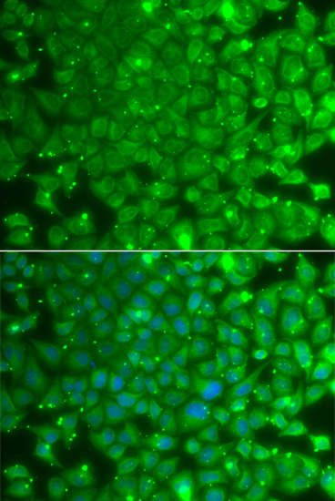 Anti-KBTBD7 Antibody (CAB7392)