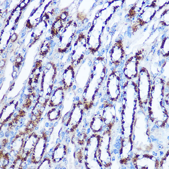 Immunohistochemistry of paraffin-embedded mouse spleen using PLK1 Rabbit mAb at dilution of 1:100 (40x lens). Perform high pressure antigen retrieval with 10 mM citrate buffer pH 6. 0 before commencing with IHC staining protocol.