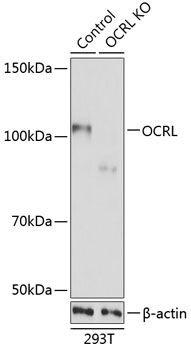 Anti-OCRL Antibody [KO Validated] (CAB19976)