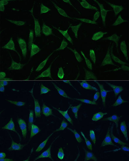 Anti-LSM14A Antibody (CAB16682)