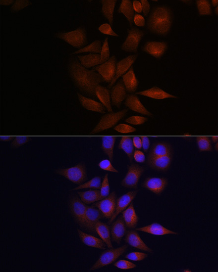 Anti-PSEN1 Antibody (CAB2187)