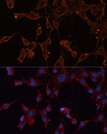 Anti-INPP5B Antibody (CAB3927)