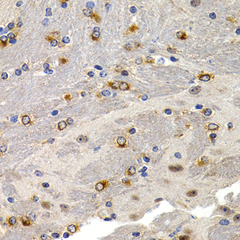 Anti-TFF1 Antibody (CAB1789)