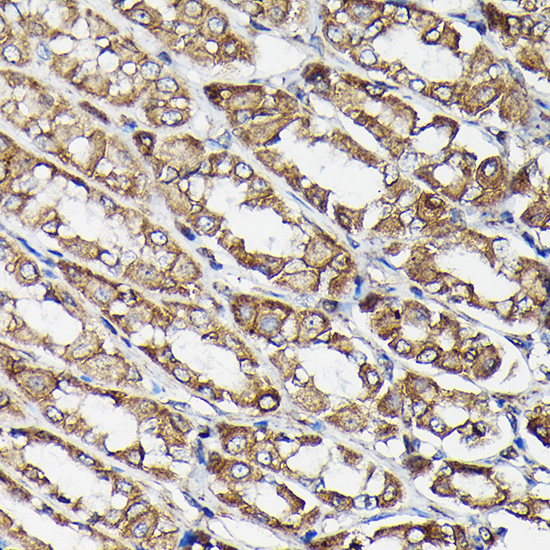 Anti-Beta-Tubulin Mouse Monoclonal Antibody (CABC021)