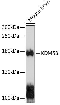 Anti-Kdm6b Antibody (CAB12763)