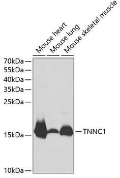 Anti-TNNC1 Antibody (CAB1927)