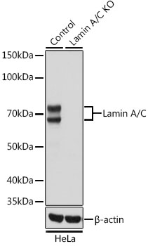 Anti-Lamin A/C Antibody [KO Validated] (CAB19524)