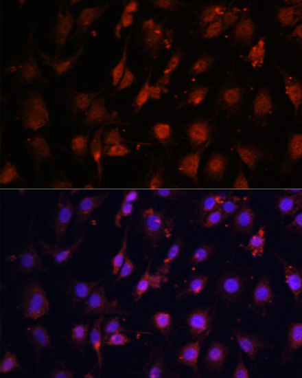 Anti-TET3 Antibody (CAB7612)