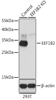 Anti-EEF1B2 Antibody [KO Validated] (CAB6580)