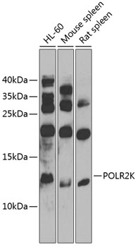 Anti-POLR2K Polyclonal Antibody (CAB9836)