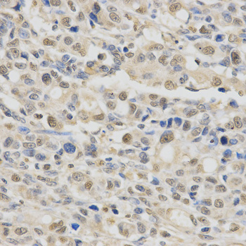 Anti-SPHK1 Antibody (CAB0139)