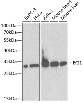 Anti-ECI1 Antibody (CAB1211)