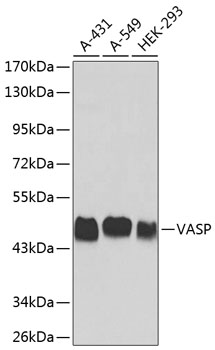 Anti-VASP Antibody (CAB0166)