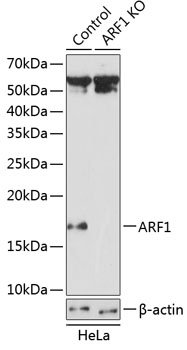 Anti-ARF1 Antibody [KO Validated] (CAB19977)