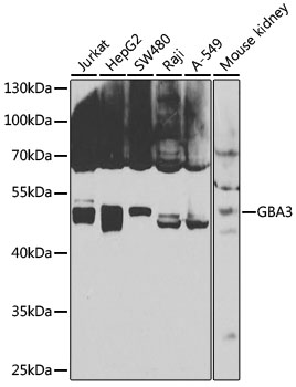 Anti-GBA3 Antibody (CAB7827)