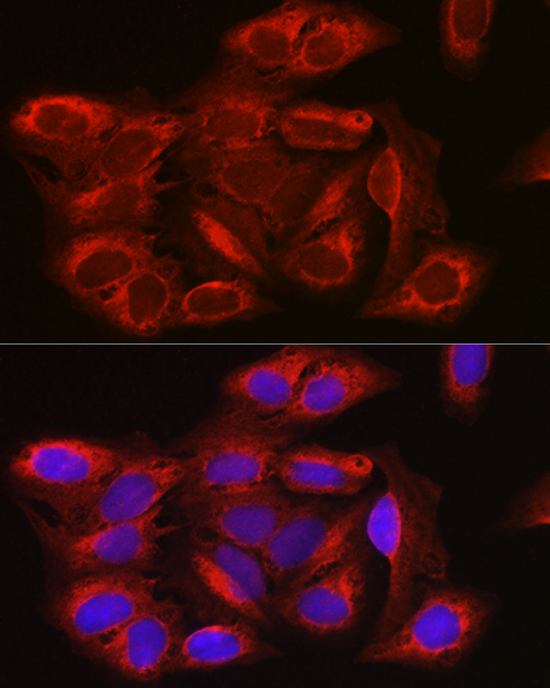 Anti-mTOR Antibody (CAB11355)