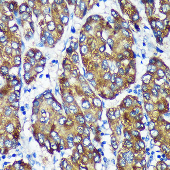 Anti-NSDHL Antibody [KO Validated] (CAB16893)