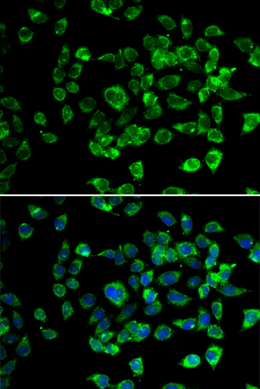 Anti-PSMD13 Antibody (CAB12485)