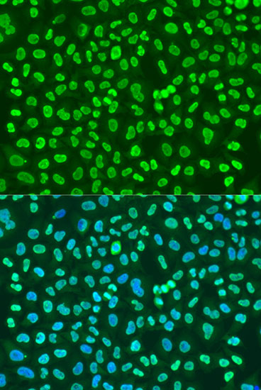 Anti-PTBP1 Antibody (CAB6107)