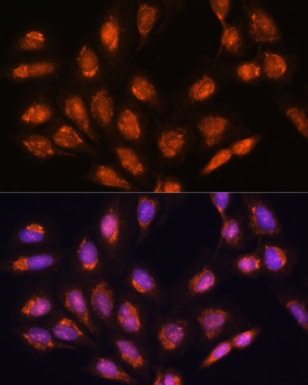 Anti-TIMM44 Antibody (CAB17446)