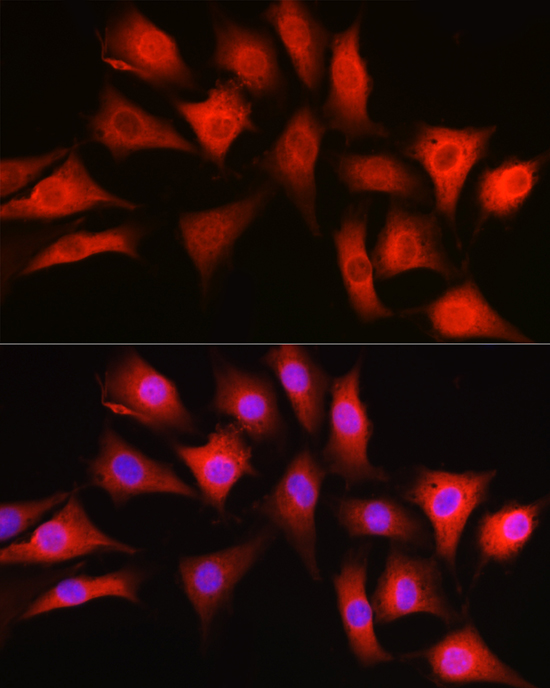 Anti-GAPDH Antibody (CABC001)