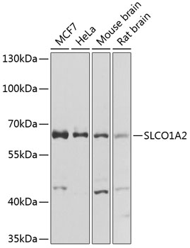 Anti-SLCO1A2 Polyclonal Antibody (CAB8452)