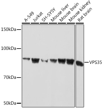 Anti-VPS35 Antibody (CAB9278)