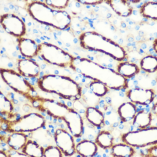 Anti-SAV1 Antibody [KO Validated] (CAB18667)