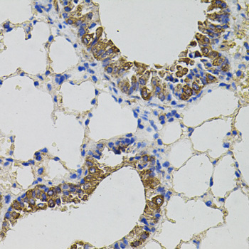 Anti-CKAP4 Antibody (CAB7777)