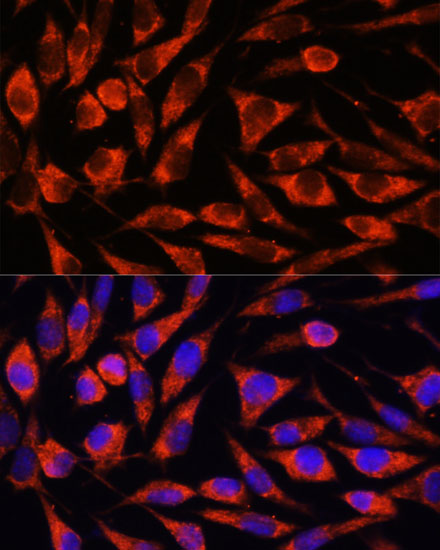 Anti-OTUD7B Antibody (CAB17329)