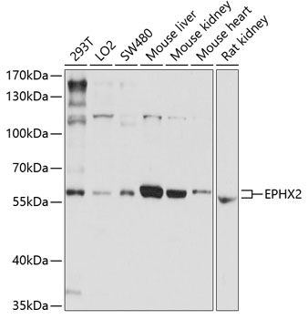 Anti-EPHX2 Antibody (CAB1885)