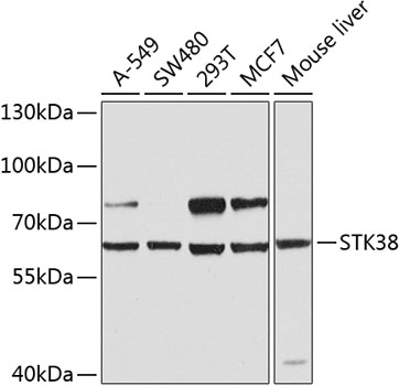 Anti-STK38 Polyclonal Antibody (CAB8191)